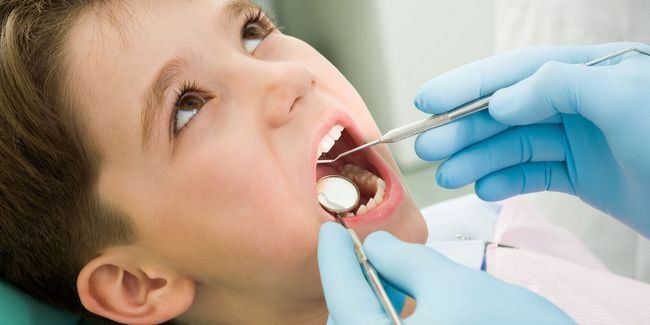 5 problèmes dentaires communs chez les enfants Photo