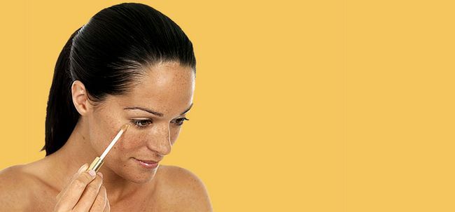 10 Accueil remèdes pour guérir les taches sombres sur votre peau Photo