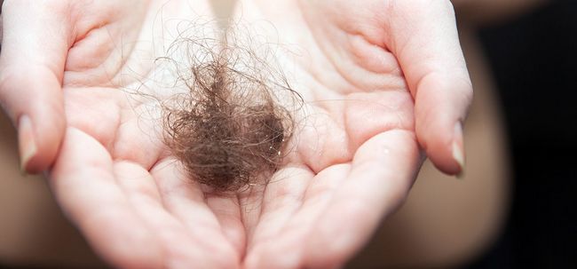 Folliculite perte de cheveux - causes, les précautions et les traitements Photo