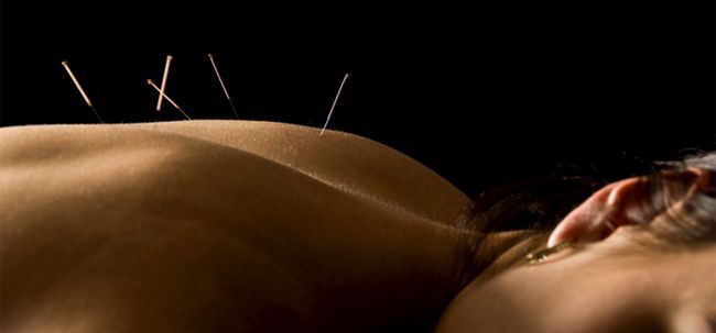 Comment ne acupuncture aider à guérir les maux de dos? Photo
