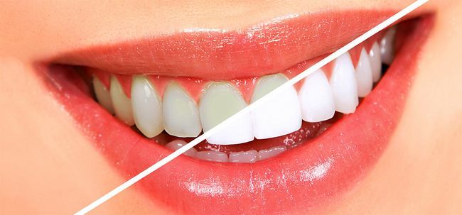 5 moyens efficaces pour une bonne santé bucco-dentaire Photo