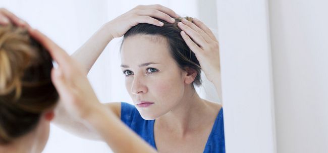 7 moyens efficaces pour traiter la perte de cheveux due à un déséquilibre hormonal Photo