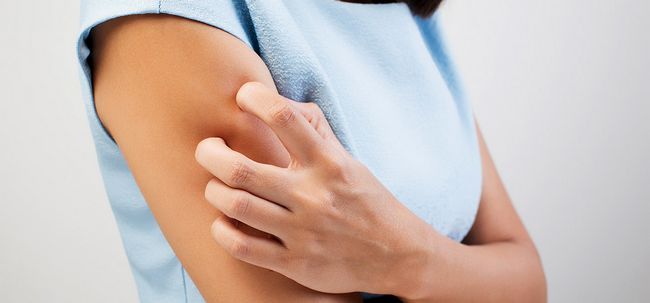 10 Symptômes et traitements pour les allergies de la peau sèche Photo