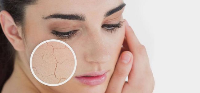 10 meilleurs conseils pour la peau sèche Photo