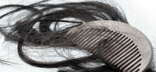20 maisons simples remèdes et des conseils pour lutter contre la chute des cheveux Photo