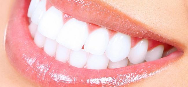 7 façons simples pour blanchir les dents Photo