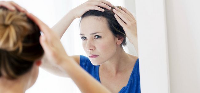 8 Différentes méthodes pour inverser la perte de cheveux Photo