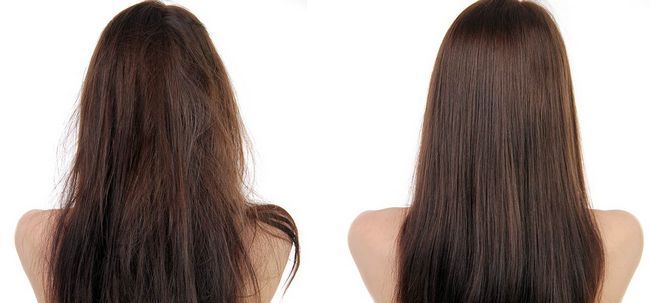 Thérapie de la croissance des cheveux bricolage qui fonctionne à merveille Photo