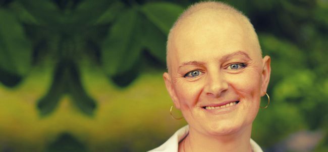 Est-ce que la chimiothérapie conduit à la perte de cheveux? Photo