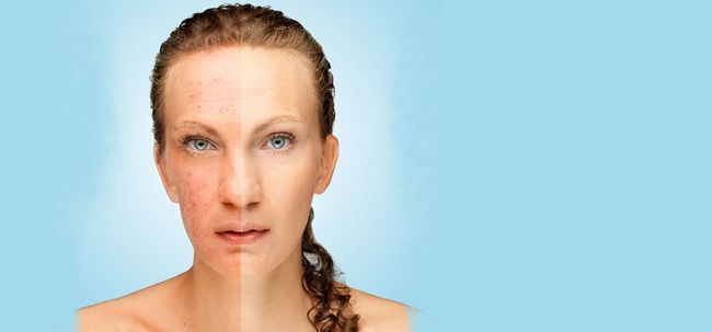 25 conseils simples pour éliminer pigmentation de la peau Photo