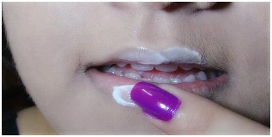 le séchage de la peau des lèvres
