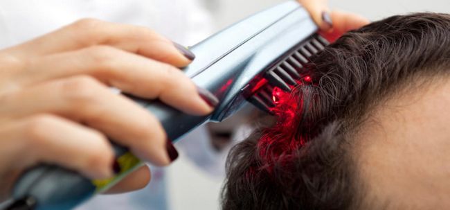 La thérapie au laser: une nouvelle façon de lutter contre la perte de cheveux Photo